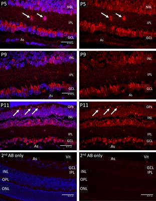 Markers of Hypoxia and Metabolism Correlate With Cell Differentiation in Retina and Lens Development